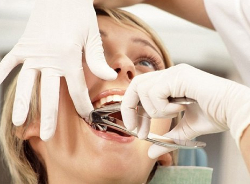 Удаление зубов в стоматологии