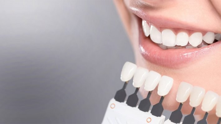 механическое отбеливание зубов отзывы