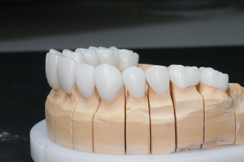 3Д снимок зубов